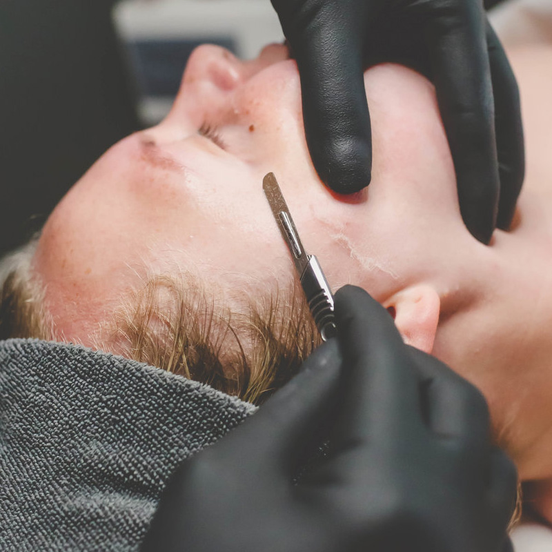 Dermaplaning for men facial hair