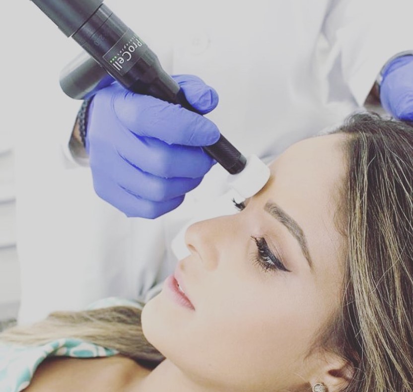 Microdermabrasion