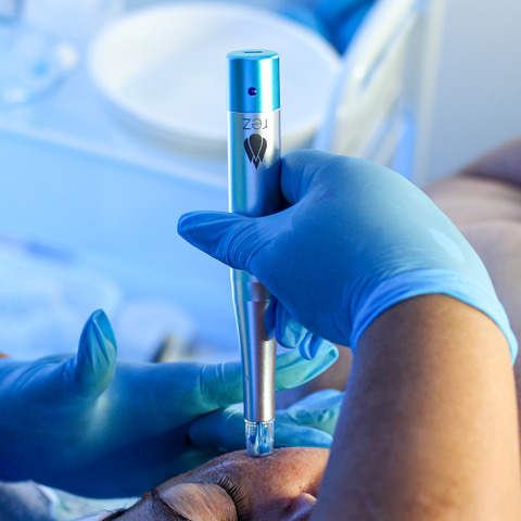 Rezenerate Nanofacial at Bloom Skin Beauty